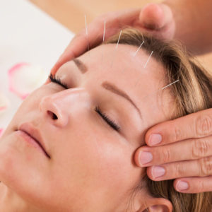 Certificate in Acupuncture