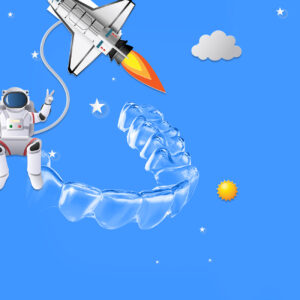 Aligners: early orthodontic treatment