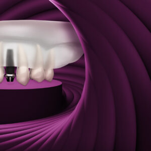 Biomechanics in orthodontics