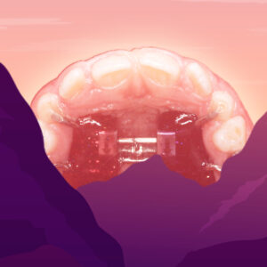 Implantation school: all stages. Basic and Intermediate level
